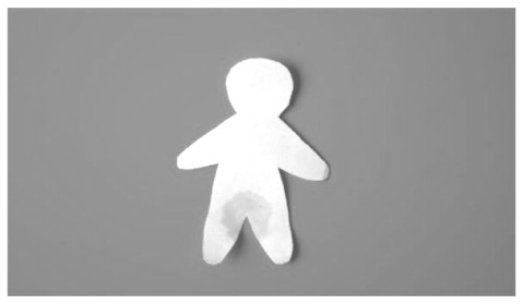 Incontinencia urinaria o enuresis nocturna en niños